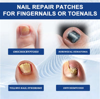 Fungal Nail Patches, Repair Thickening Gray Nail Rotten Nails Embedded Nails Soft Nails Bright Nails Toe Care