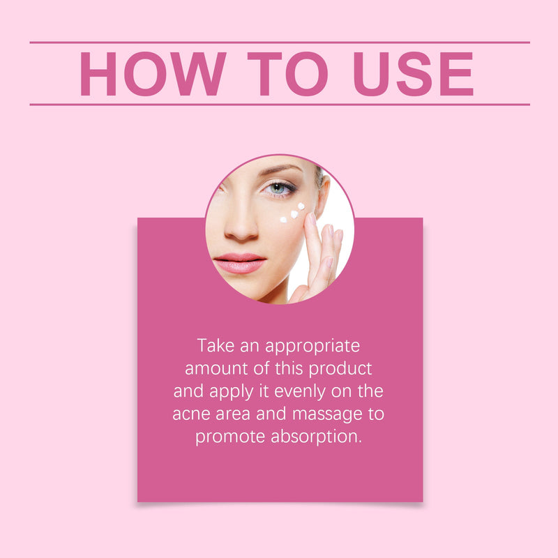 Facial Acne Cream, Repair Facial Acne, Close The Mouth To Nourish Skin Tender And Smooth Skin Care Cream