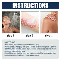 South Moon Eczema Therapy Spray, Repair Skin Redness And Itchiness Cowskin Moss Care Spray