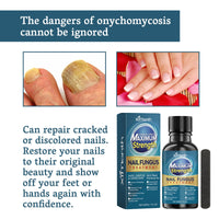 Nail Fungus Treatment, Nail Thickening Of Embedded Light Mail This Soft Armour Brothers Nails Detailer