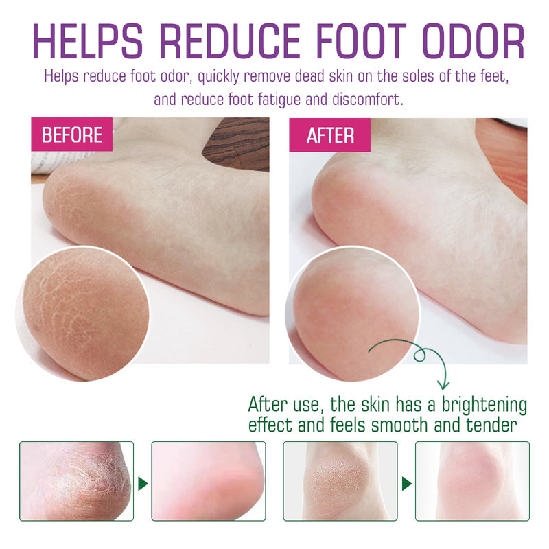 Foot Bath Salts, Moisturize Foot Skin Deep Cleansing Relieves Muscle Soreness Slimming Cold Foot Bath Salts