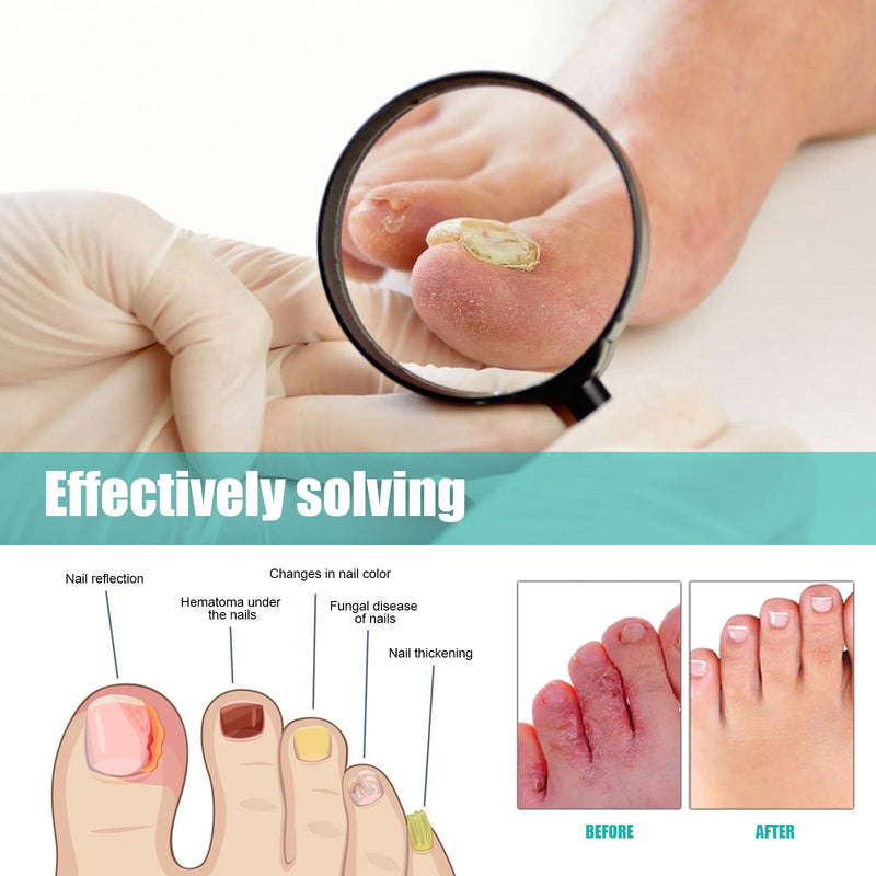 Nail Care Spray Soft Nails Thickening Nails Gray Nails Cleaning Odor Brightening Nails Spray