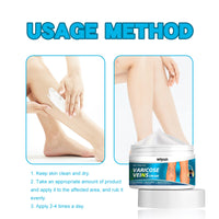 Varicose Veins Cream, Muscle Soreness And Swelling Relief Discomfort Smoothing Blood Vessel Massage Cream