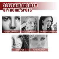 Brightening Cream For Blemish Reduction, Brightening Skin, Moisturizing Beauty And Lightening Face Cream For Yellow Spots