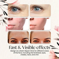Skin Collagen Hydrate Stick, Moisturize And Lighten The Fine Neck Lines And Tighten The Skin
