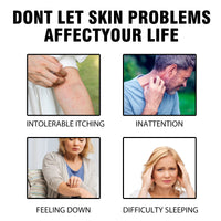 Psoriasis Herbal Treatment Spray, Repair Hands And Feet Skin Redness And Itchiness Moisturizing Smooth Skin Care Spray