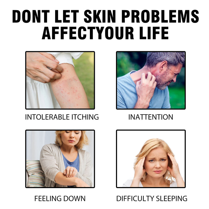 Psoriasis Herbal Treatment Spray, Repair Hands And Feet Skin Redness And Itchiness Moisturizing Smooth Skin Care Spray