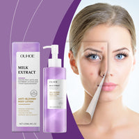 OUHOE Berry Scented Acne Moisturizing Lotion, lightens acne, firming skin, cleansing, moisturizing and smoothing