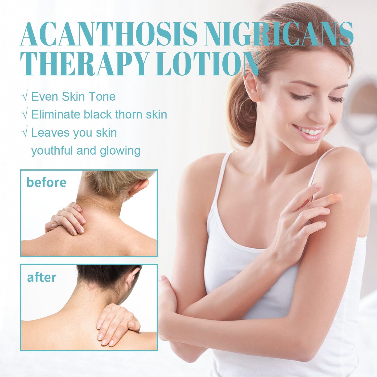 Acanthosis Nigricans Therapy Lotion, Armpit Joint Knee Fade Melanin Deep Nourishing Whitening Skin Tender Skin