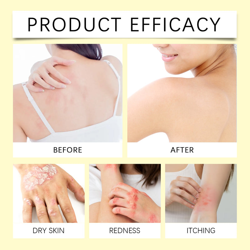 Skin Repair Patch, Moisturizing Skin And Hands And Feet, Skin And Body Care Patch
