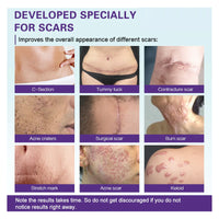 West&Month High-quality Silicone Scar Gel, Lighten Acne Mark Scar Repair Skin Smoothing Care Cream