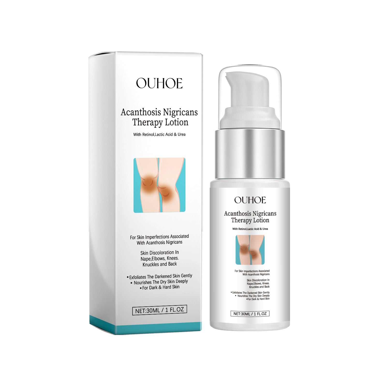 Acanthosis Nigricans Therapy Lotion, Armpit Joint Knee Fade Melanin Deep Nourishing Whitening Skin Tender Skin