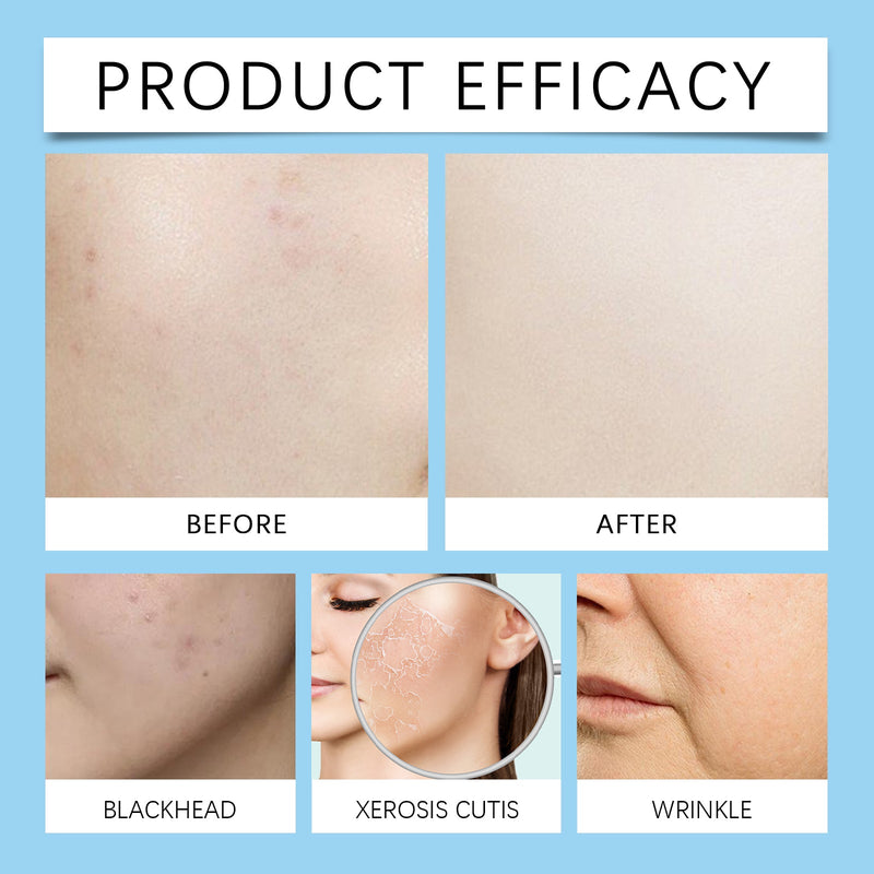 2% Salicylic Acid Balancing Repair Serum, Moisturizing And Improving Acne Closing Essence