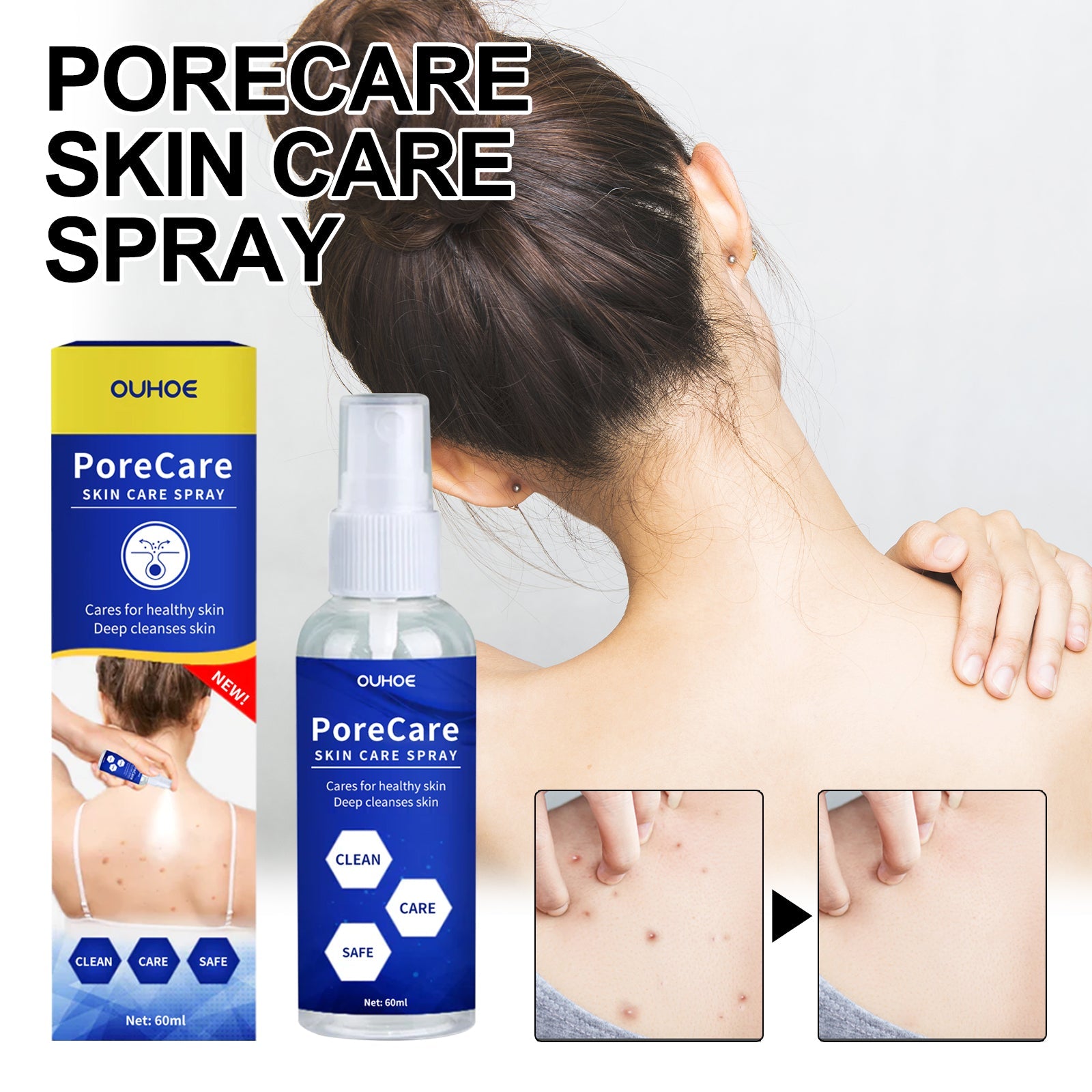 Porecare Skin Care Spray, Cleanser Warts Fade Moles Corns Smooth Skin Care Spray