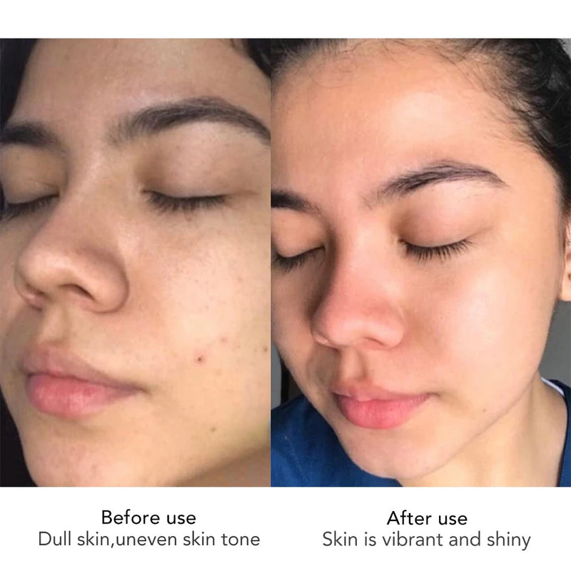 Face Cream with Hyaluron Scars Whitening Moisturizing Lifting Anti-Aging Women Sleeping Dry Korean Bleaching Skin Care