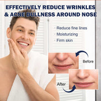 East Moon Anti-Wrinkle Patch For Men, Smoothing And Firming The Fine Lines In The Corners Of The Eyes And Lightening The Wrinkles On The Head