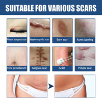 EELHOE Scar Balm, Surgery Scar Repair Cold Compress Scar Skin Scar Gel Balm
