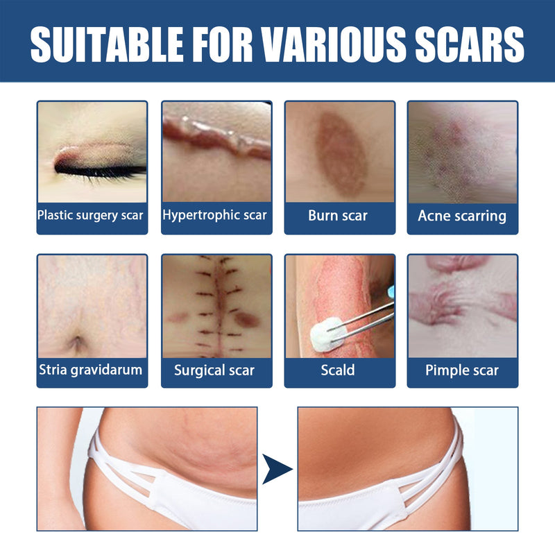 EELHOE Scar Balm, Surgery Scar Repair Cold Compress Scar Skin Scar Gel Balm