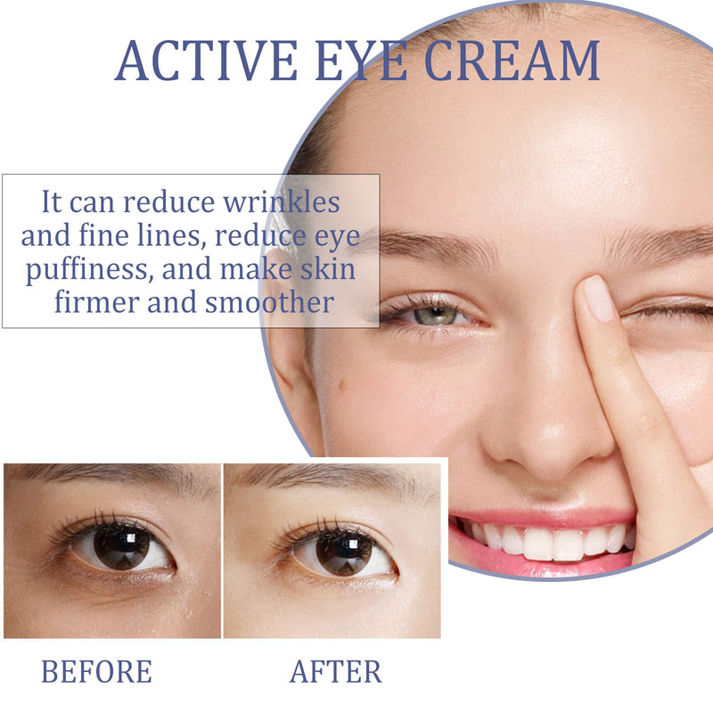 Active Eye Cream, Repair Eye Bags And Dark Circles Elastic Firming Skin Around The Eyes Anti-Wrinkle Eye Cream