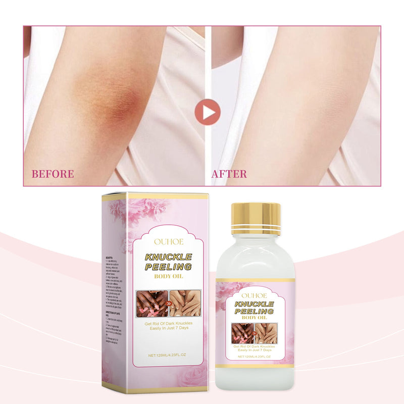 Ouhoe Body Whitening Concentrate, Deep Moisturizing And Nourishing Joint Peeling Body Care Essence