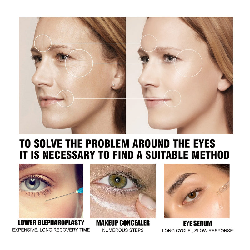 Eye Firming Cream, Lightening Fine Lines, Bags, Dark Circles, Firming And Moisturizing Eye Cream