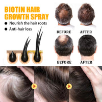 EELHOE Biotin Hair Growth Spray, Strong Anti-Rip Repair Hair Care And Root Stabilization Spray