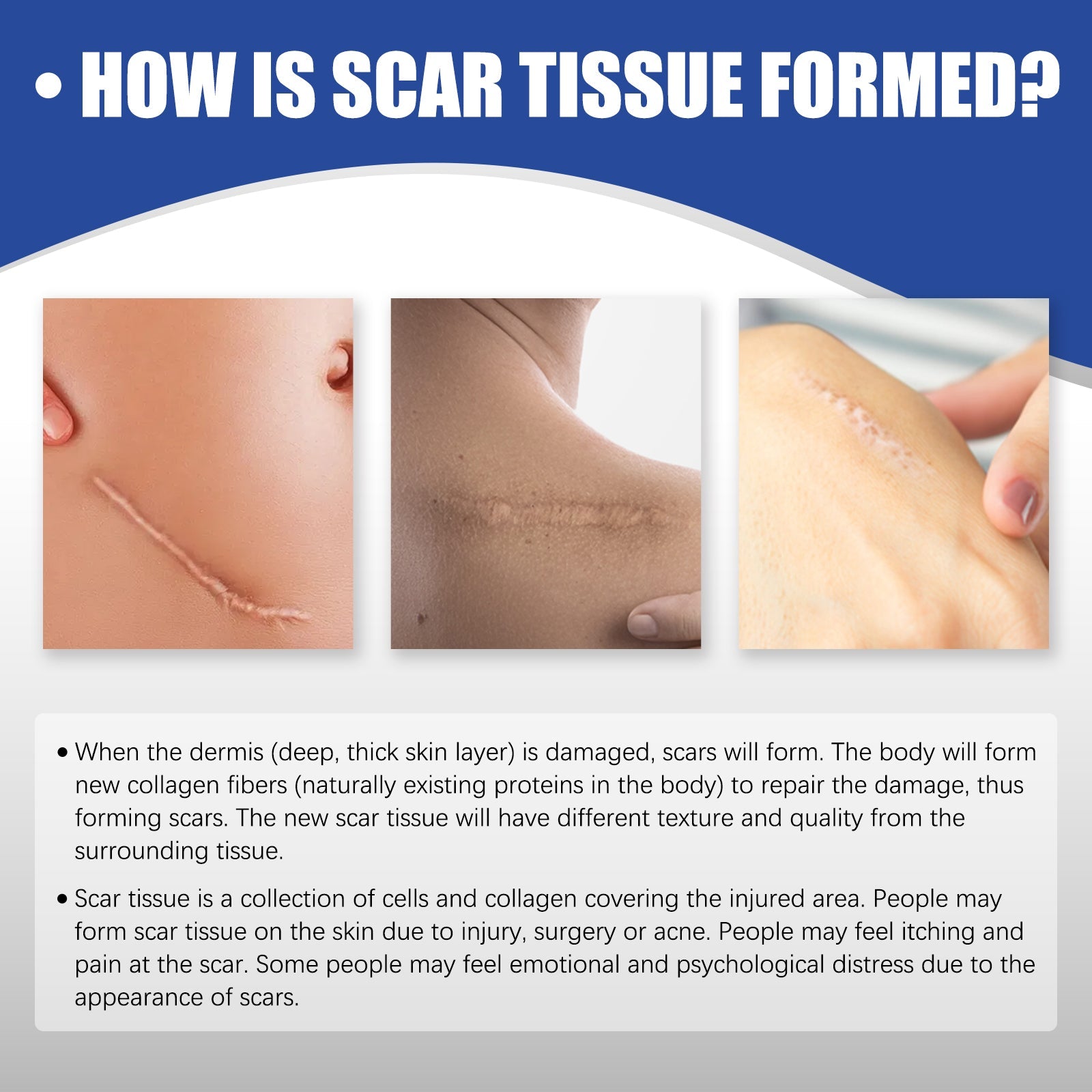 Scar Care Silicone Tape Skin Wound Scar Care Smooth Skin Body Care Patch
