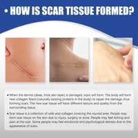 Scar Care Silicone Tape Skin Wound Scar Care Smooth Skin Body Care Patch