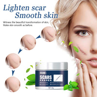 EELHOE Scar Balm, Surgery Scar Repair Cold Compress Scar Skin Scar Gel Balm