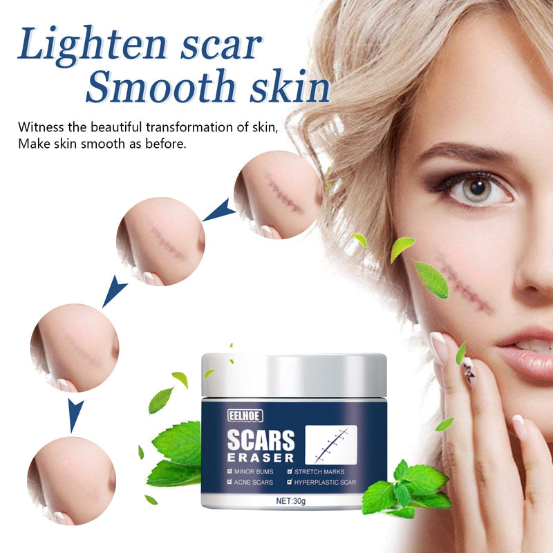 EELHOE Scar Balm, Surgery Scar Repair Cold Compress Scar Skin Scar Gel Balm