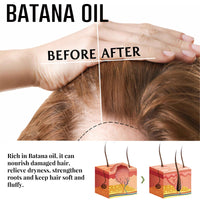 Batana Dense Hair Ball Nourishing Hair Roots Thickening Hair Strengthening Hair Scalp Massage Treatment