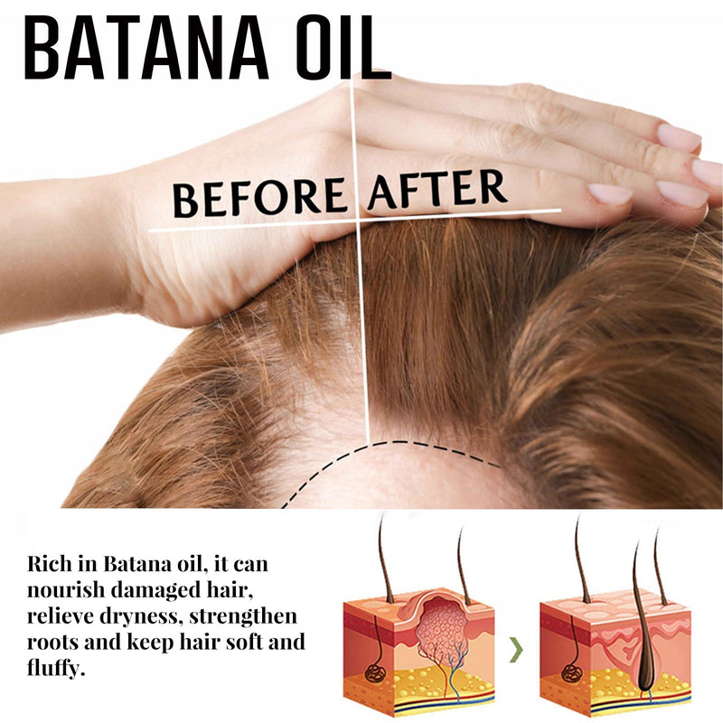 Batana Dense Hair Ball Nourishing Hair Roots Thickening Hair Strengthening Hair Scalp Massage Treatment