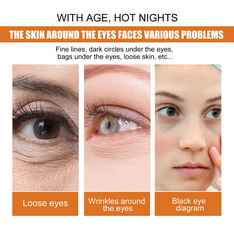 Turmeric Eye Cream Turmeric Vitamin C Moisturizing Eye Cream To Reduce Eye Lines And Care For The Skin Around The Eyes