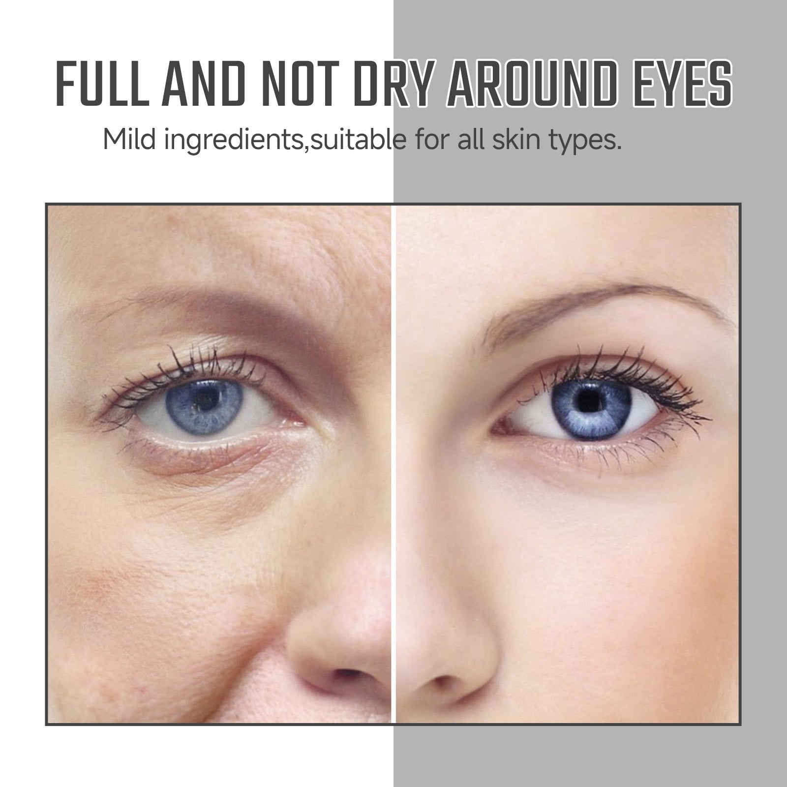 Instant Eye Care Essence Reduces Wrinkles And Dark Circles, Brightens Skin, And Moisturizes The Skin Around The Eyes