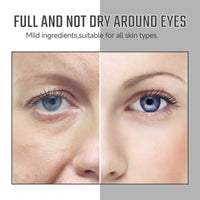 Instant Eye Care Essence Reduces Wrinkles And Dark Circles, Brightens Skin, And Moisturizes The Skin Around The Eyes