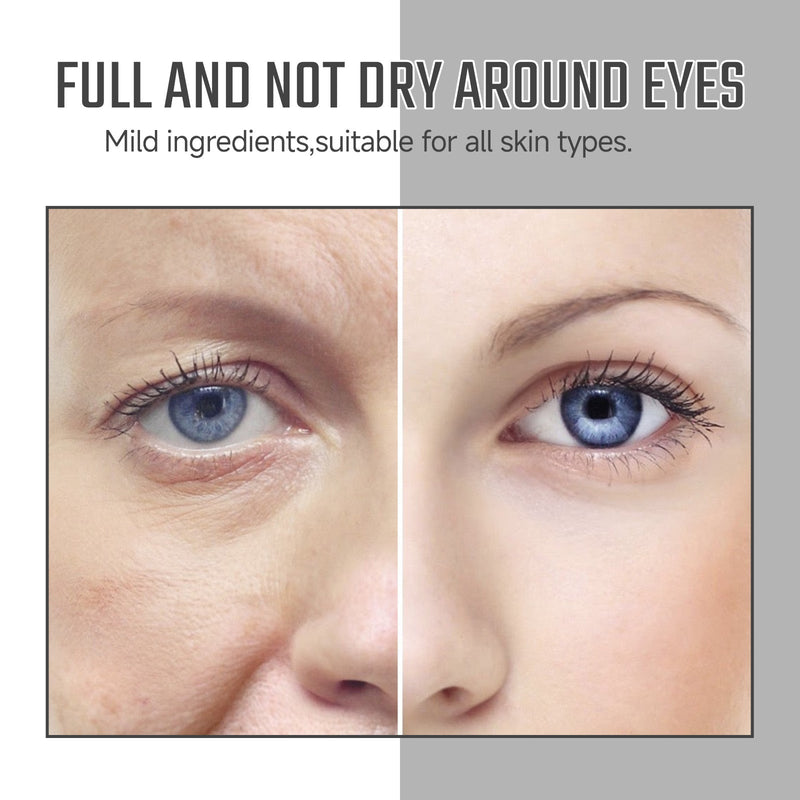 Instant Eye Care Essence Reduces Wrinkles And Dark Circles, Brightens Skin, And Moisturizes The Skin Around The Eyes