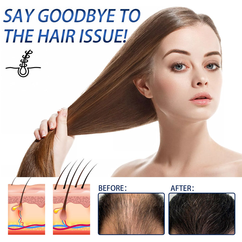 OUHOE Regain Hair Spray, Moisturize And Repair Dry Hair And Frizz, Strengthen Hair And Prevent Hair Loss