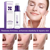 West&Month High-quality Silicone Scar Gel, Lighten Acne Mark Scar Repair Skin Smoothing Care Cream