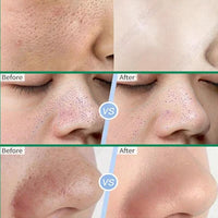 Salicylic Acid Pore Clearing Cream Shrink Pores Remove Blackheads Acne Brighten Moisturizing Smooth Skin Care Korean Products