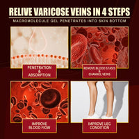 Vein Repair Agent Varicose Massage Relieves Earthworm Leg Repair Soreness And Swelling Body Care