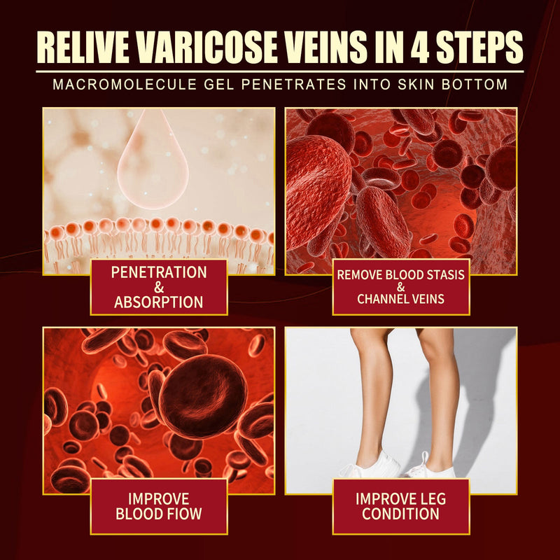 Vein Repair Agent Varicose Massage Relieves Earthworm Leg Repair Soreness And Swelling Body Care