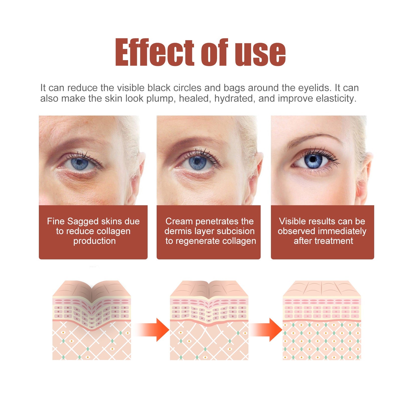 Eye Care Eye Cream, Reduces Fine Lines, Bags And Dark Circles, Skin Around Eyes Moisturizes And Tightens Cream