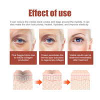 Eye Care Eye Cream, Reduces Fine Lines, Bags And Dark Circles, Skin Around Eyes Moisturizes And Tightens Cream