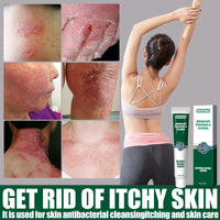 Wet Search Herbal Cream, Skin Cream Moisturizes, Hydrates And Reduces Itching Herbal Cream