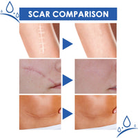 Jaysuing Scar Cream, Fade Scars Smooth And Firming Skin Repair Cream
