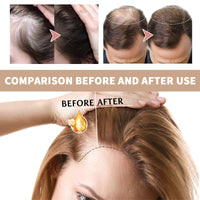 Hair Boost Essence, Improve Dry Short-Tempered Prevent Hair Nourishing Strength Repair Hair Root Hair, Protect Hair Oil