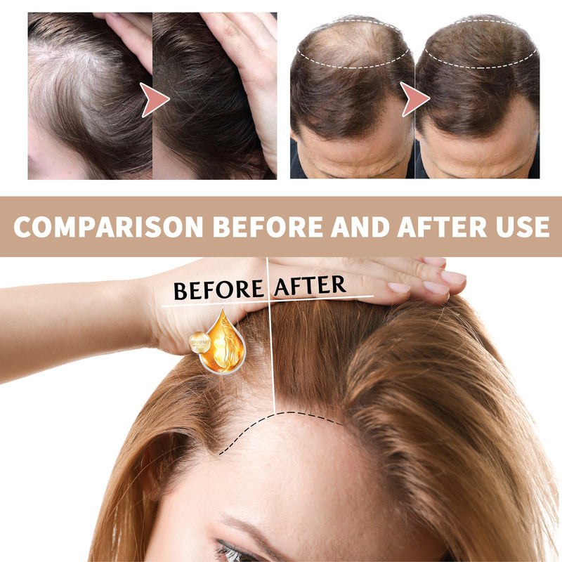 Hair Boost Essence, Improve Dry Short-Tempered Prevent Hair Nourishing Strength Repair Hair Root Hair, Protect Hair Oil