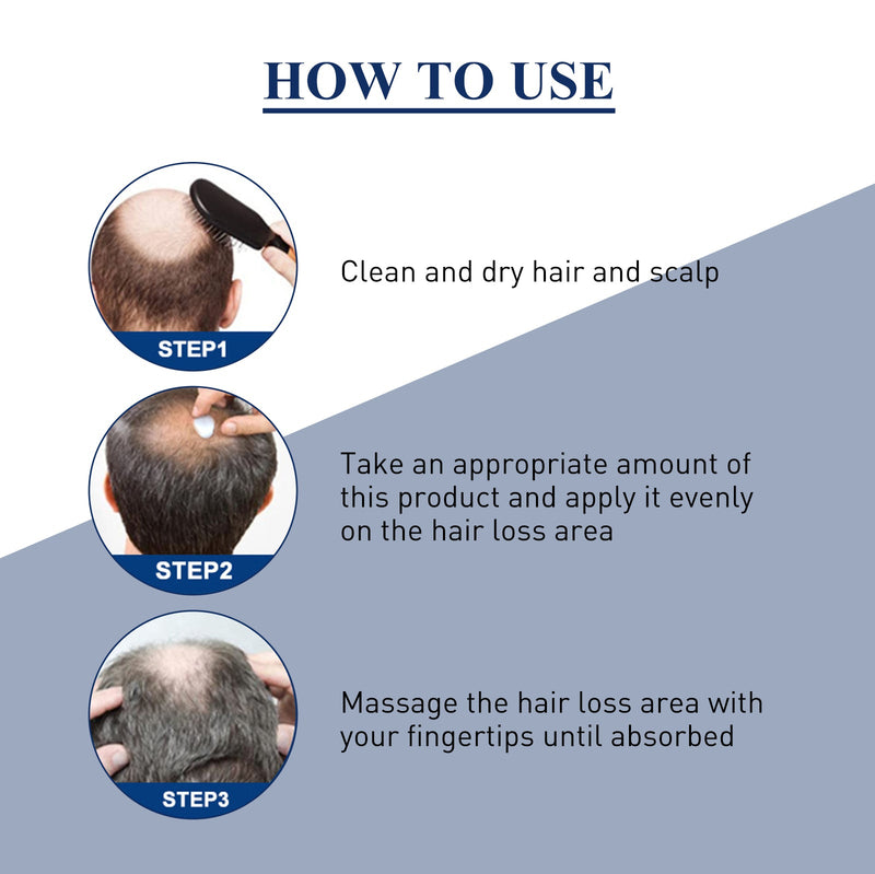 Alopecias Hair Growth Cream, Scalp Deep Nutrition Hair Repair Hair Follicle Rejuvenating Gloss Brightening Cream