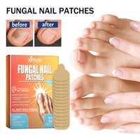 Fungal Nail Patches, Repair Thickening Gray Nail Rotten Nails Embedded Nails Soft Nails Bright Nails Toe Care