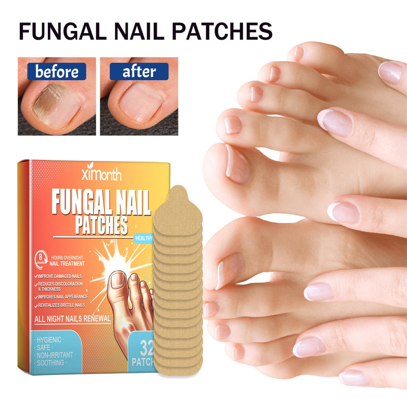 Fungal Nail Patches, Repair Thickening Gray Nail Rotten Nails Embedded Nails Soft Nails Bright Nails Toe Care